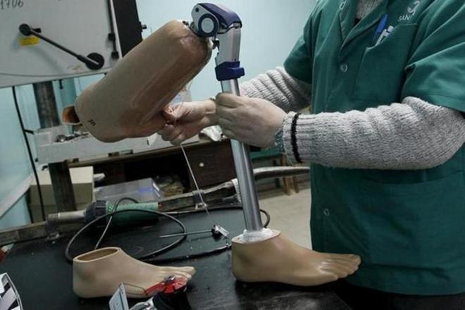 Prosthetic limbs, exoskeletons, software algorithm, Prosthetic limbs new development, Prosthetic limbs taking feedback from human body